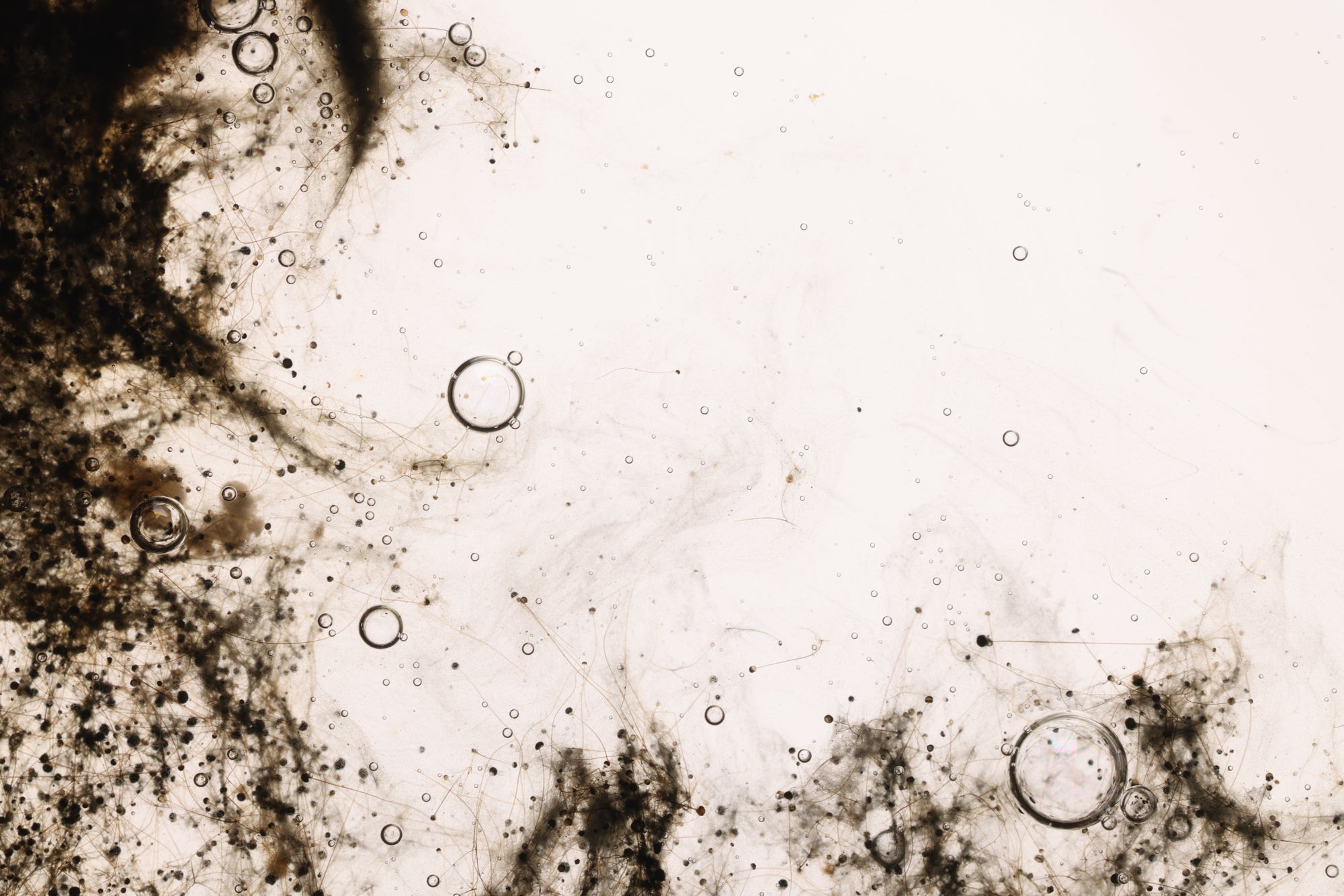 Breakthrough in Biofilm Research Offers Hope for Infection-Free Wounds